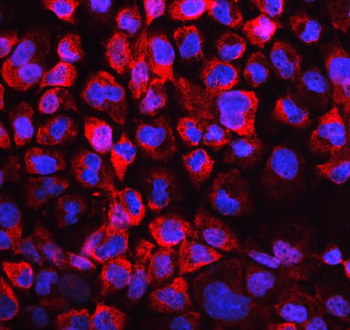 Anti-Lactate Dehydrogenase B/LDHB Antibody