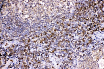Anti-Lactate Dehydrogenase B/LDHB Antibody