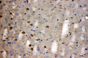 Anti-Lactate Dehydrogenase B/LDHB Antibody