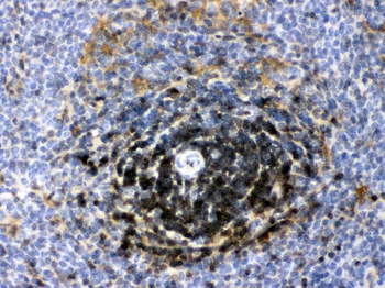 Anti-Lactate Dehydrogenase B/LDHB Antibody