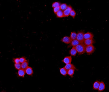 MPP1 Rabbit Polyclonal Antibody