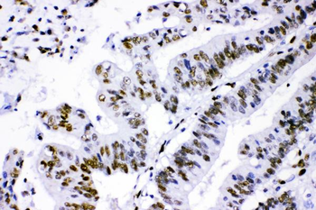 Anti-PML Protein Antibody