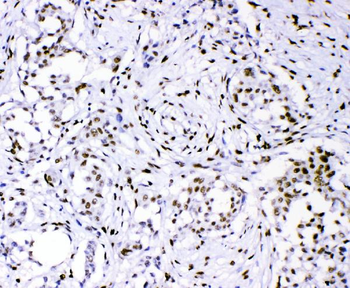 Anti-PML Protein Antibody