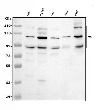 Anti-PML Protein Antibody