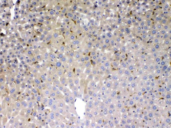 Anti-Phosphoserine Aminotransferase/PSAT1 Antibody