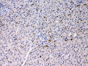 Anti-Phosphoserine Aminotransferase/PSAT1 Antibody