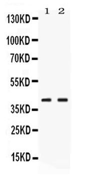 Anti-Phosphoserine Aminotransferase/PSAT1 Antibody