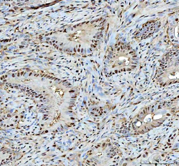Anti-Proteasome 20S C2/PSMA1 Antibody