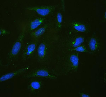 Anti-RPL19 Antibody