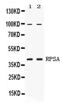 67kDa Laminin Receptor/RPSA Antibody