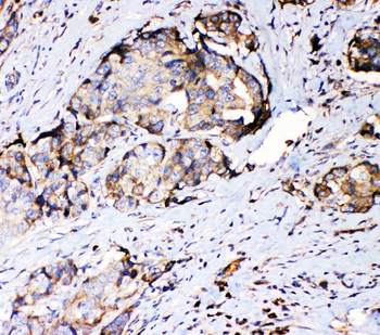 Anti-67kDa Laminin Receptor/RPSA Antibody