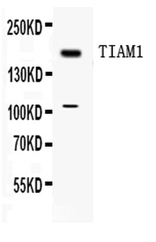 TIAM1 Rabbit Polyclonal Antibody