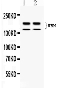 Werner's syndrome helicase WRN/WRN Rabbit Polyclonal Antibody