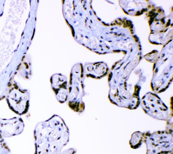 Anti-AFF4 Antibody