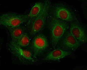 Anti-Angiogenin/ANG Antibody