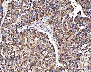 Anti-Angiogenin/ANG Antibody
