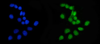 Anti-APRT Antibody