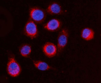 Anti-ARFGAP1 Antibody