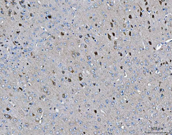 Anti-ARFGAP1 Antibody