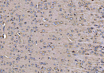 Anti-ARFGAP1 Antibody