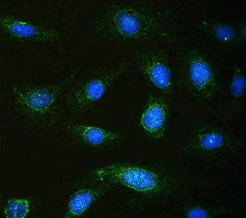 Anti-Calpastatin/CAST Antibody