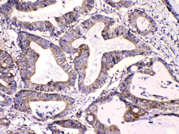 Anti-Calpastatin/CAST Antibody