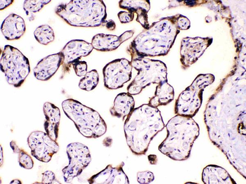Anti-Calpastatin/CAST Antibody