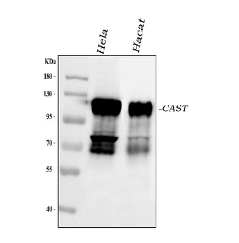 Anti-Calpastatin/CAST Antibody