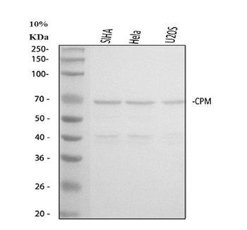 Anti-Carboxypeptidase M/CPM Antibody