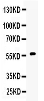 Cytochrome P450 17A1/CYP17A1 Antibody