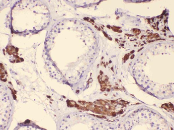 Anti-Cytochrome P450 17A1/CYP17A1 Antibody