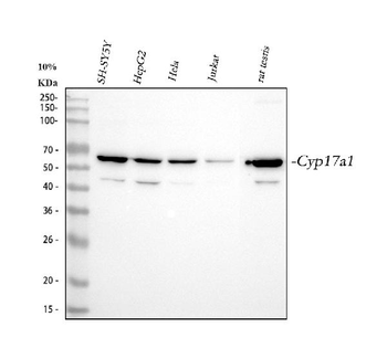 Anti-Cytochrome P450 17A1/CYP17A1 Antibody