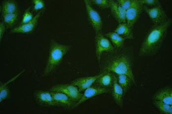 Anti-Diazepam Binding Inhibitor/DBI Antibody