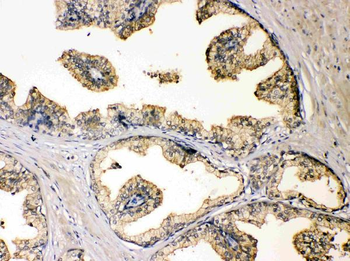 Anti-Diazepam Binding Inhibitor/DBI Antibody