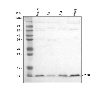 Anti-Diazepam Binding Inhibitor/DBI Antibody