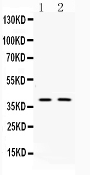 Doublecortin/DCX Rabbit Polyclonal Antibody