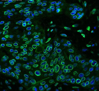 Anti-Emerin/EMD Antibody