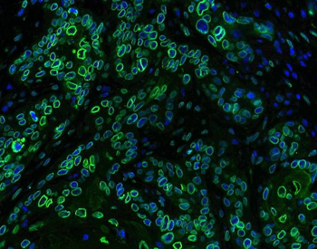Anti-Emerin/EMD Antibody