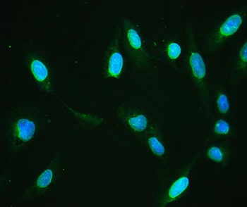 Anti-Emerin/EMD Antibody