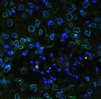 Anti-Emerin/EMD Antibody