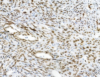 Anti-Emerin/EMD Antibody