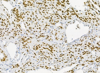 Anti-Emerin/EMD Antibody