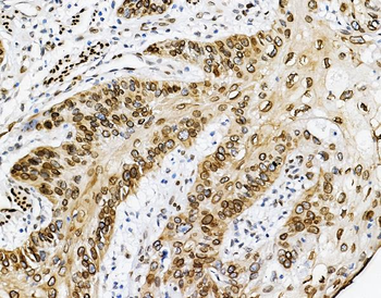 Anti-Emerin/EMD Antibody