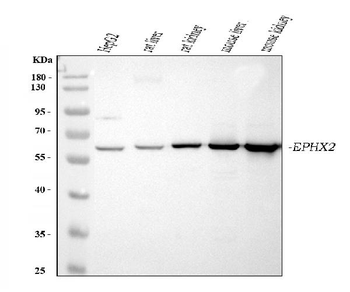 Anti-EPHX2 Antibody