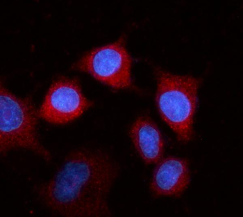 Anti-Fibrinogen beta chain/FGB Antibody