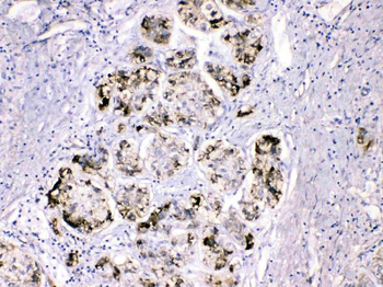 Anti-Fibrinogen gamma chain/FGG Antibody