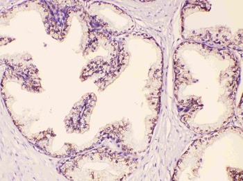 Anti-GAA Antibody