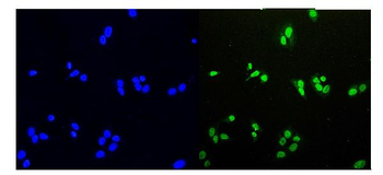 Anti-HDGF Antibody