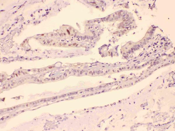 Anti-HDGF Antibody