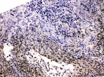 Anti-HDGF Antibody
